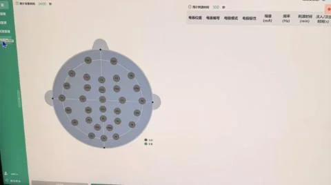 现在脑机接口的产品经理，到底在做什么?